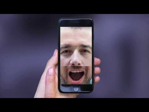 SPLITEE gallery image