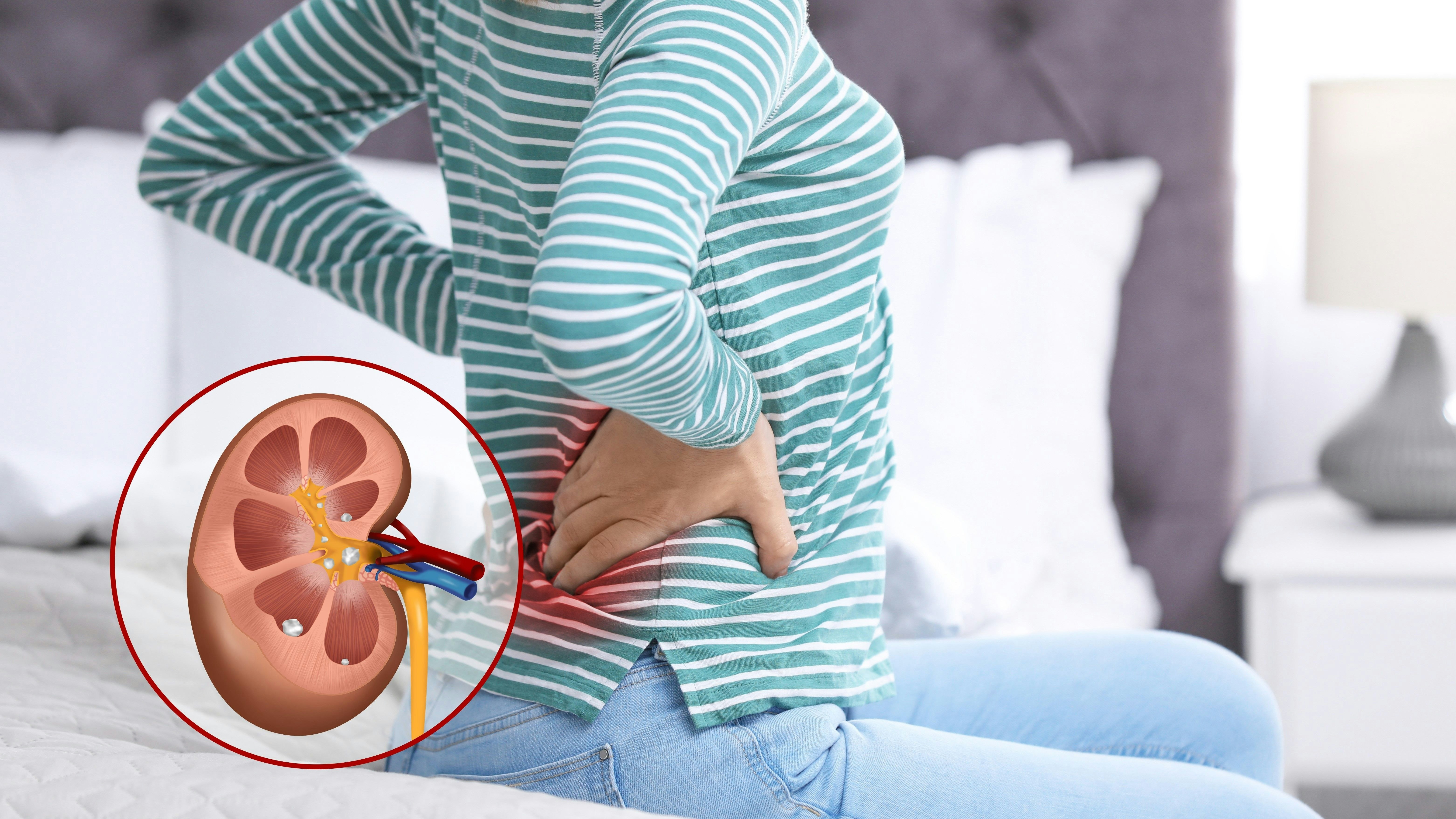 Kidneycop