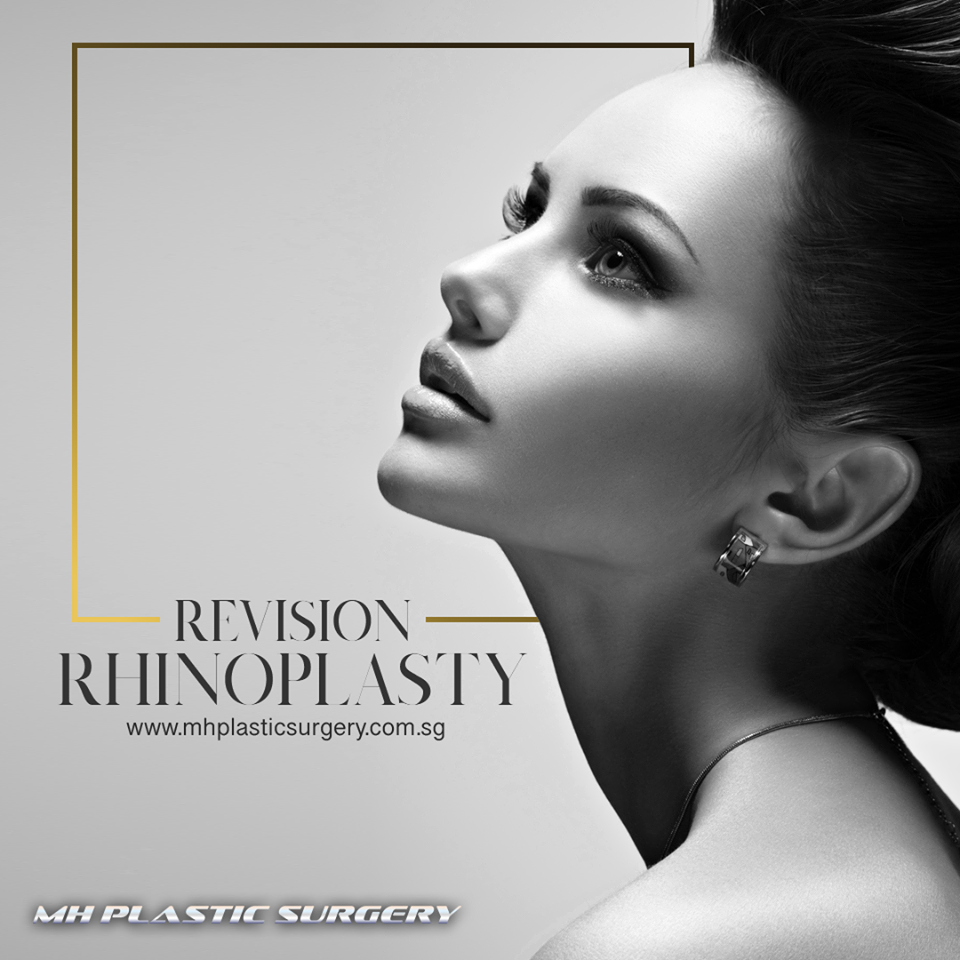 Eye Bag Removal | Thread lift gallery image
