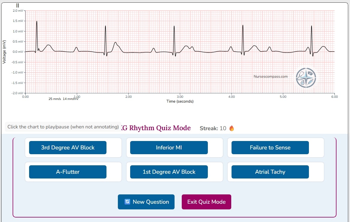 Nurses Compass EKG Simulator gallery image