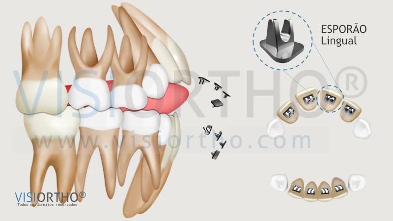 VISIORTHO screenshot 3