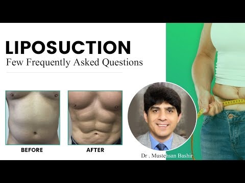 Liposuction in Lahore gallery image
