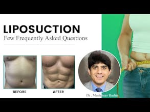 Liposuction in Lahore gallery image
