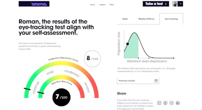 Anima β an eye-tracking solution gallery image