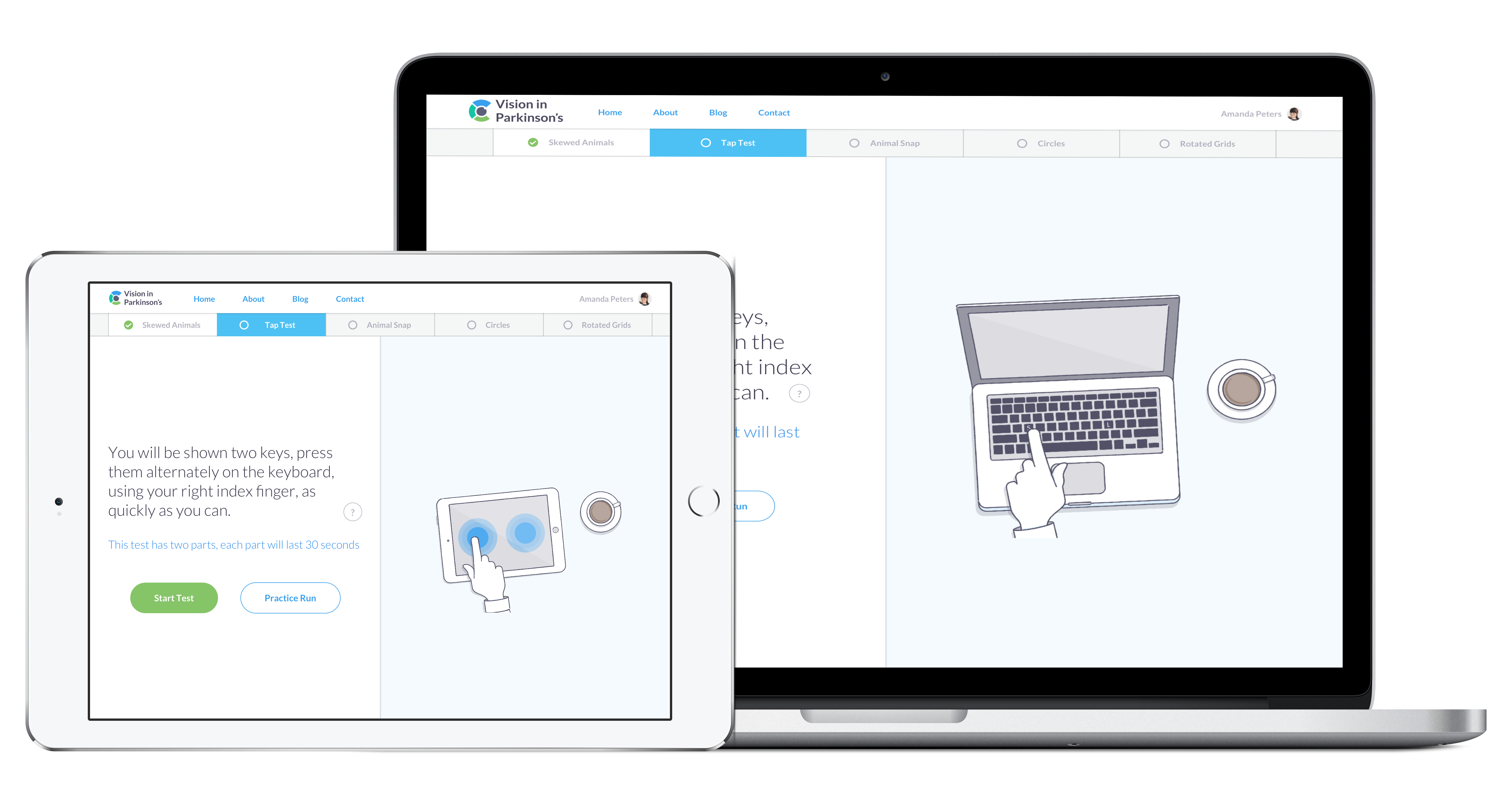 Vision In Parkinson's gallery image