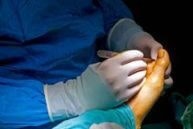 Podiatric Sports Medicine Doctor LA gallery image