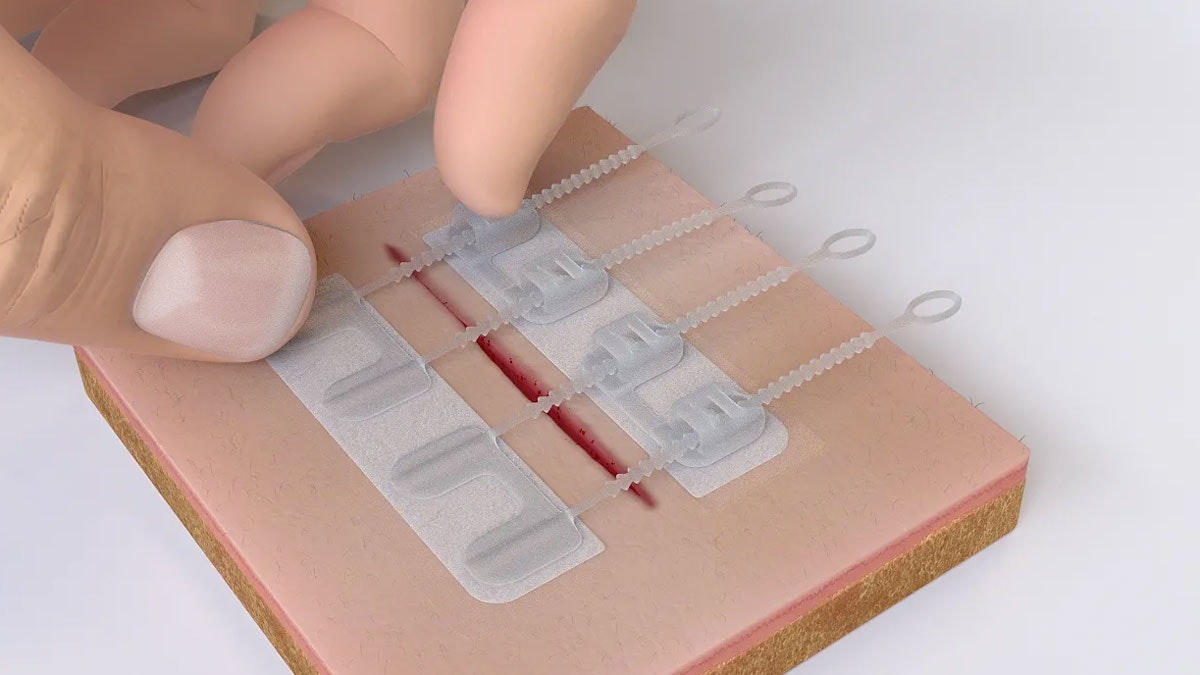 ZipStitch ⛑ gallery image