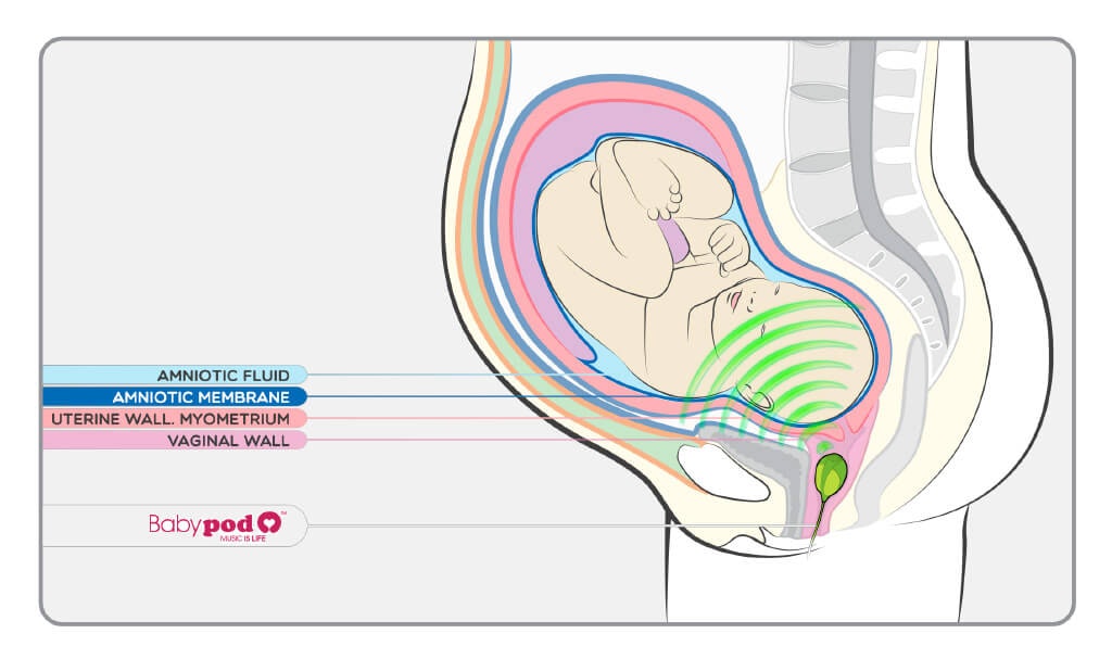 Babypod gallery image