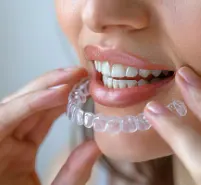 Dental Implant gallery image