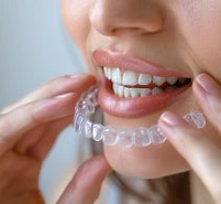 Dental Implant  - Screenshot 2 showing product features and functionality