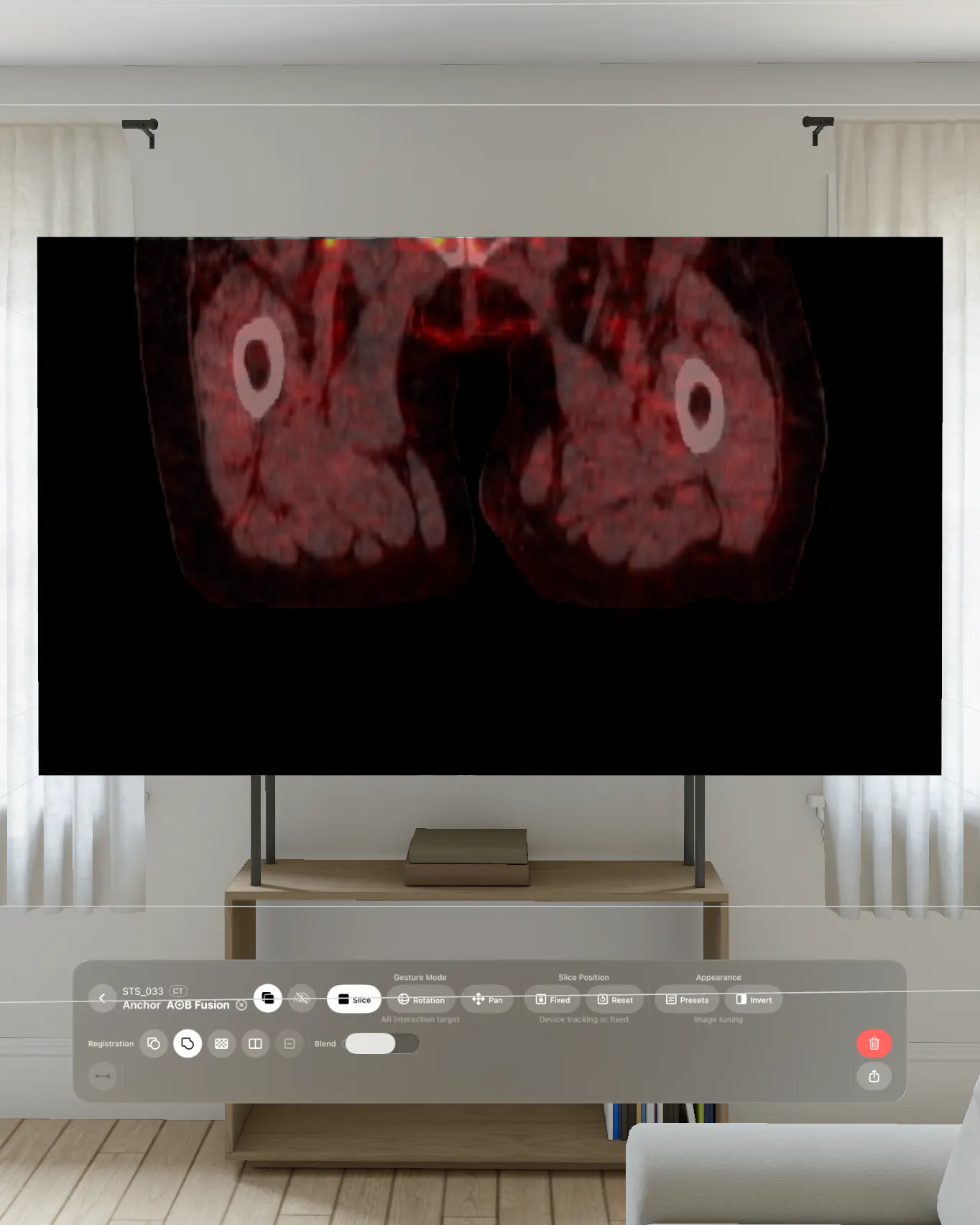 VoxelVision - DICOM Viewer gallery image