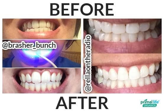 Primal Life Organics LED Denti sbiancanti - Sbiancamento dei denti, bocca sana media 7