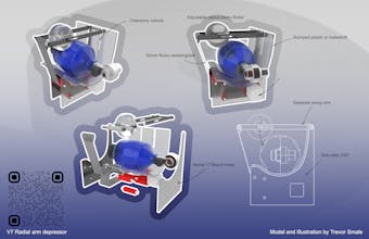 Open Lung - Open Source Ventilator gallery image