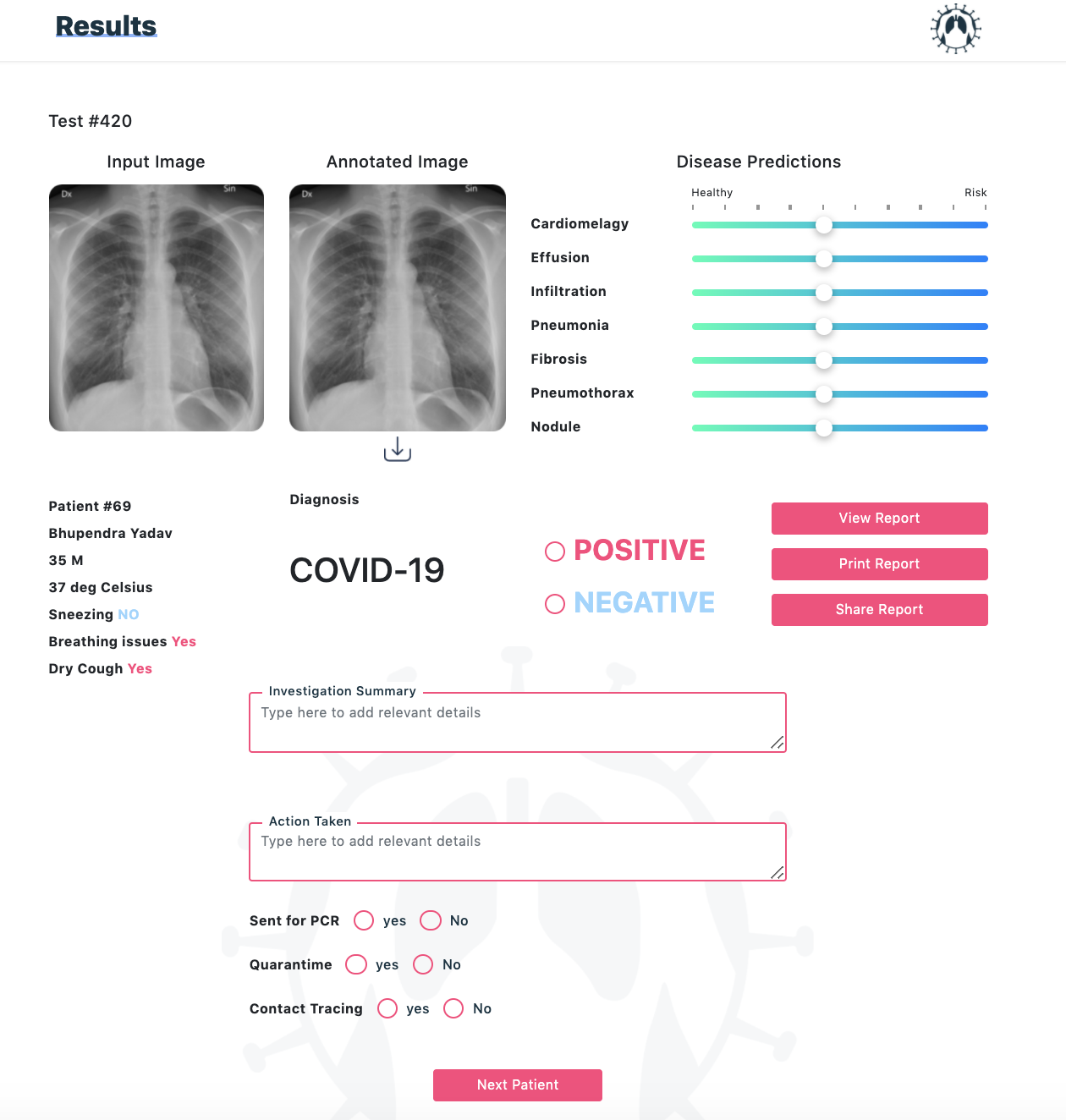 RayEye gallery image