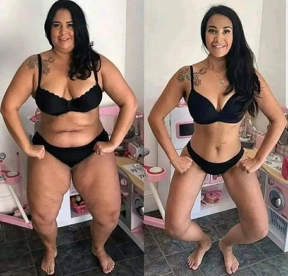 Weight loss medication. gallery image