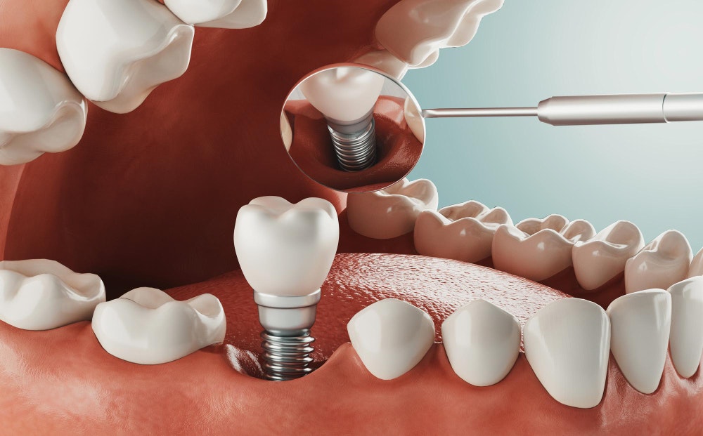 Drzaki’s international Dental Care gallery image