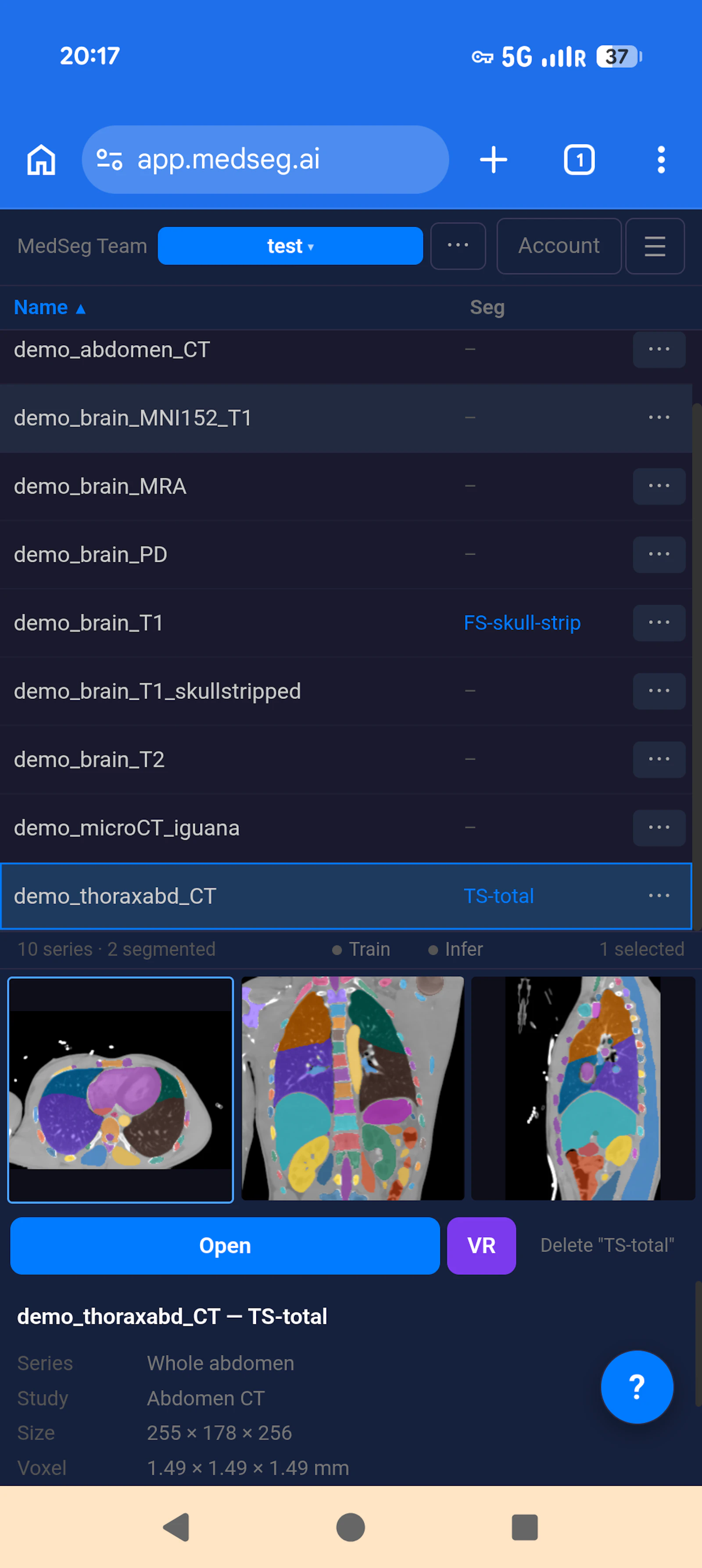 MedSeg screenshot 6