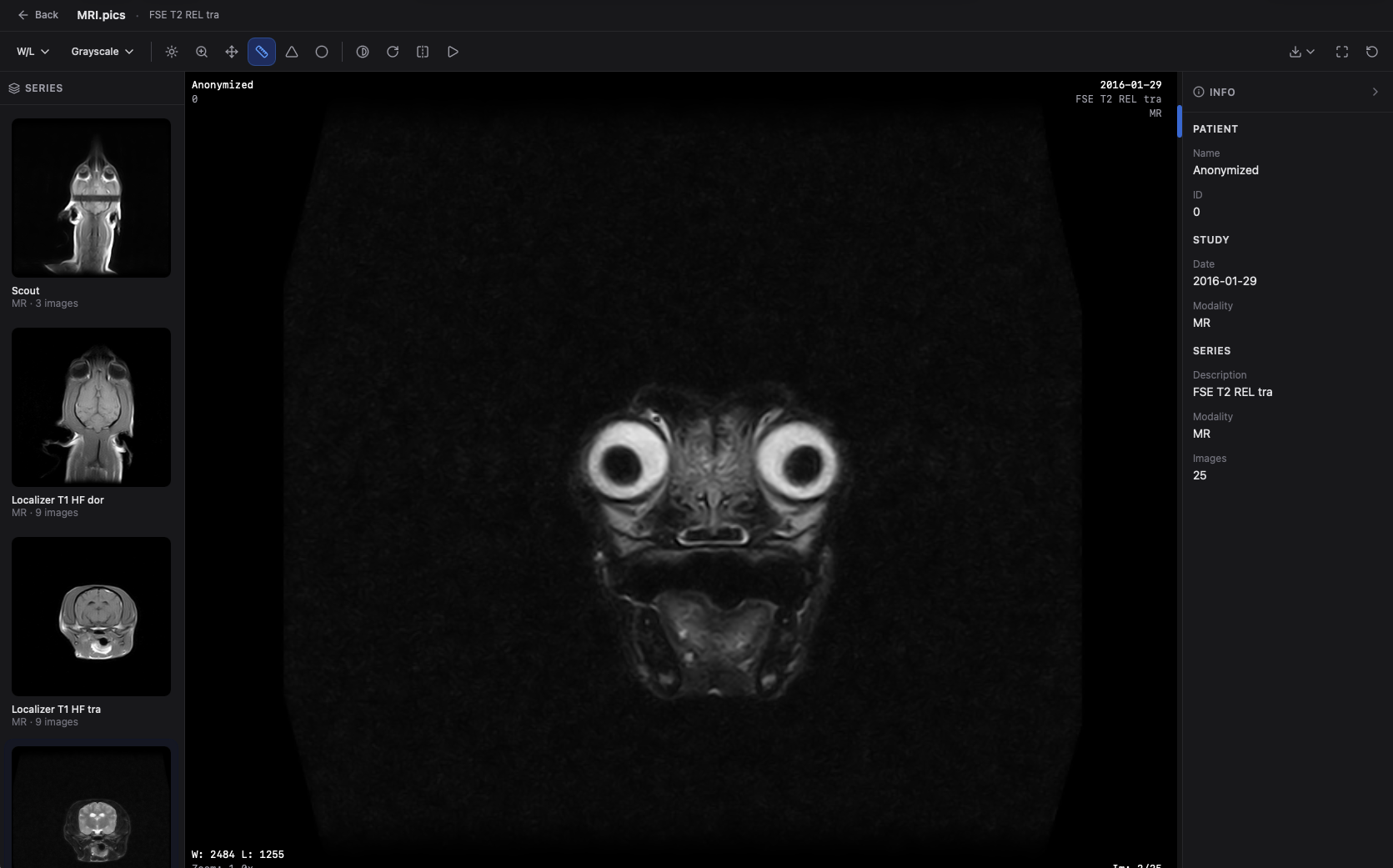 MRI.pics gallery image