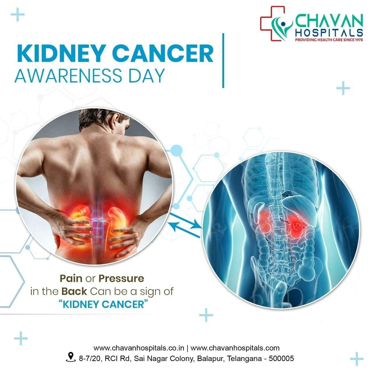 Best Nephrologist in Hyderabad