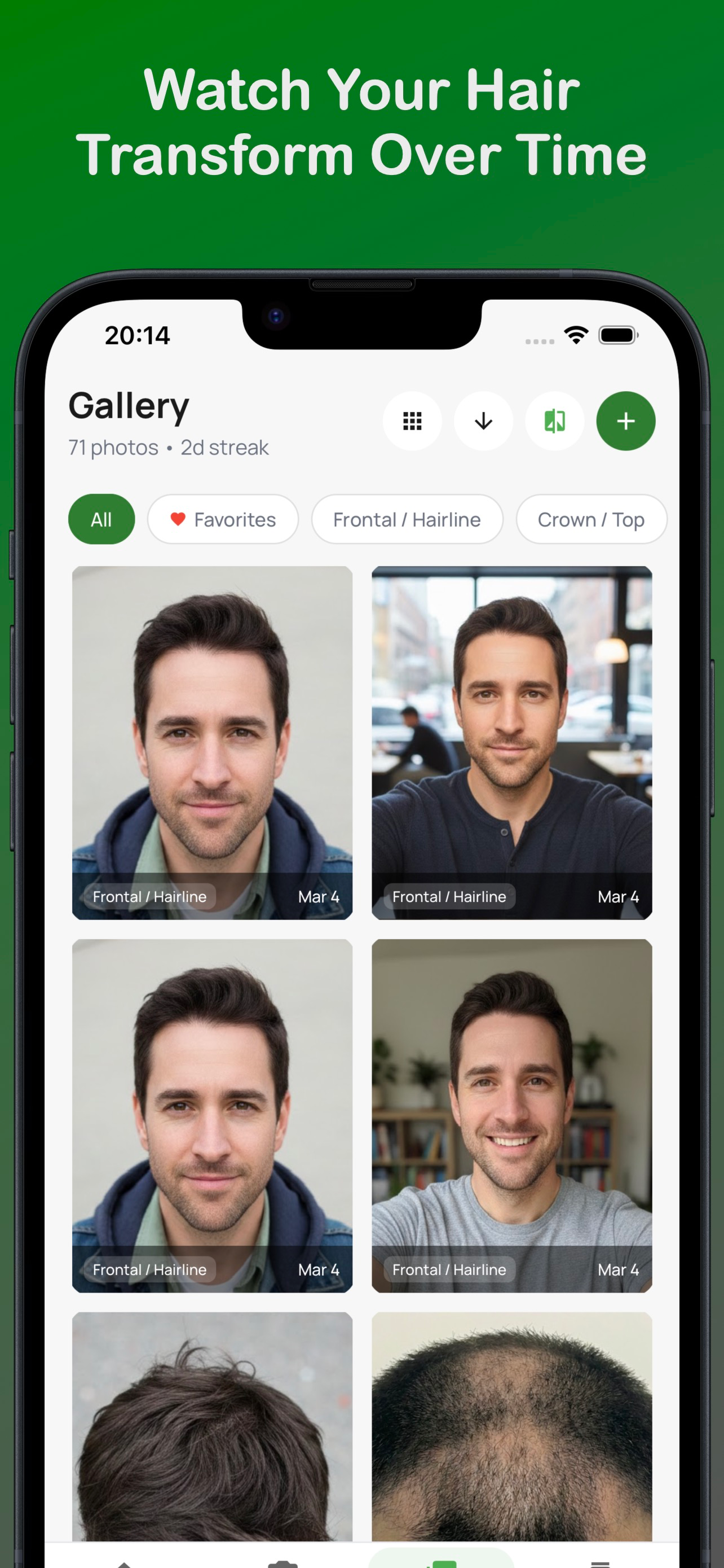 Trichometrics gallery image