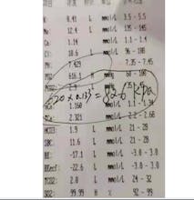 Portable high-dissolved-oxygen equipment gallery image