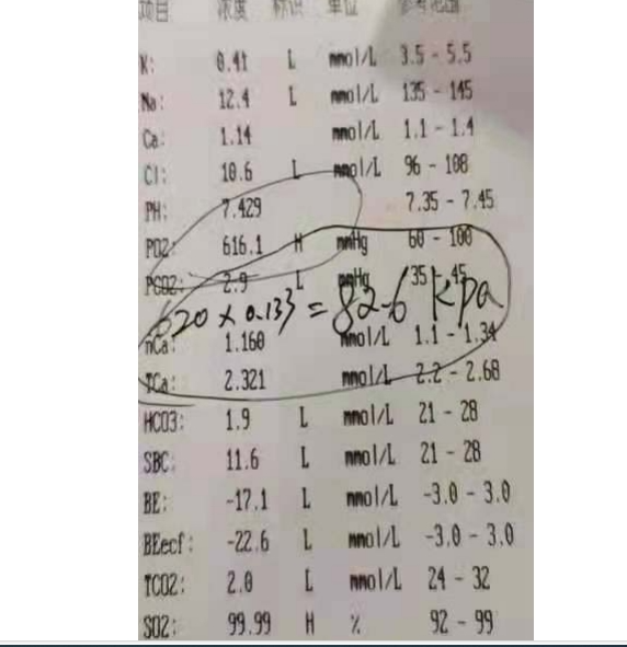 Portable high-dissolved-oxygen equipment - Screenshot 3 showing product features and functionality