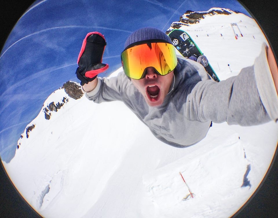 Black eye  gallery image