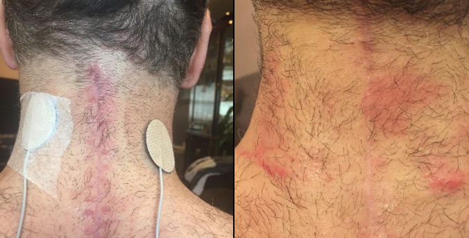 NewGel+ gallery image