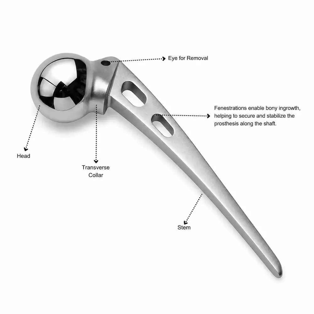 Austin Moore Hip Prosthesis gallery image
