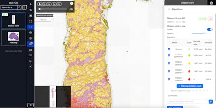 CancerCenterAI Platform gallery image