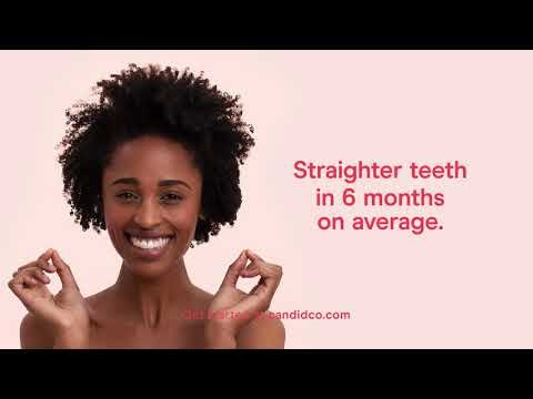 Candid gallery image