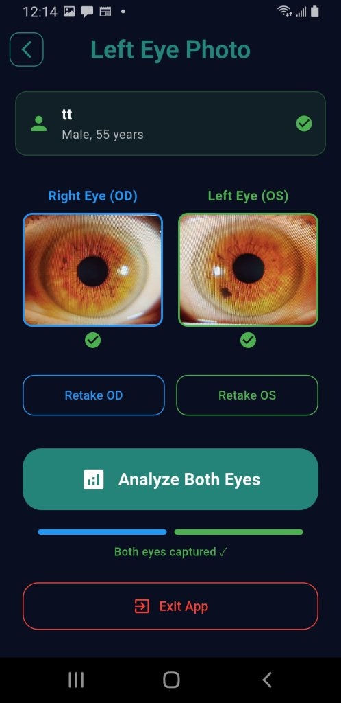 PupilMetrics Research Tool gallery image