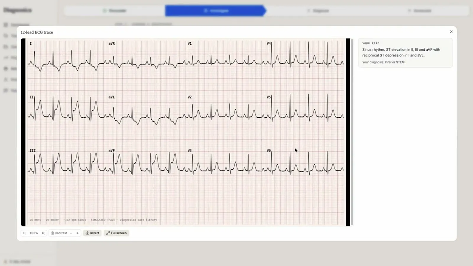 Diagnosica screenshot 1 (video preview)