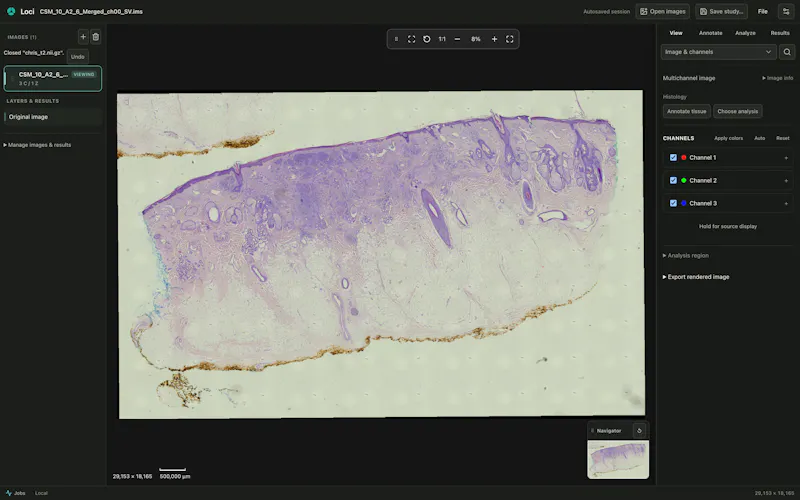 Loci screenshot 4