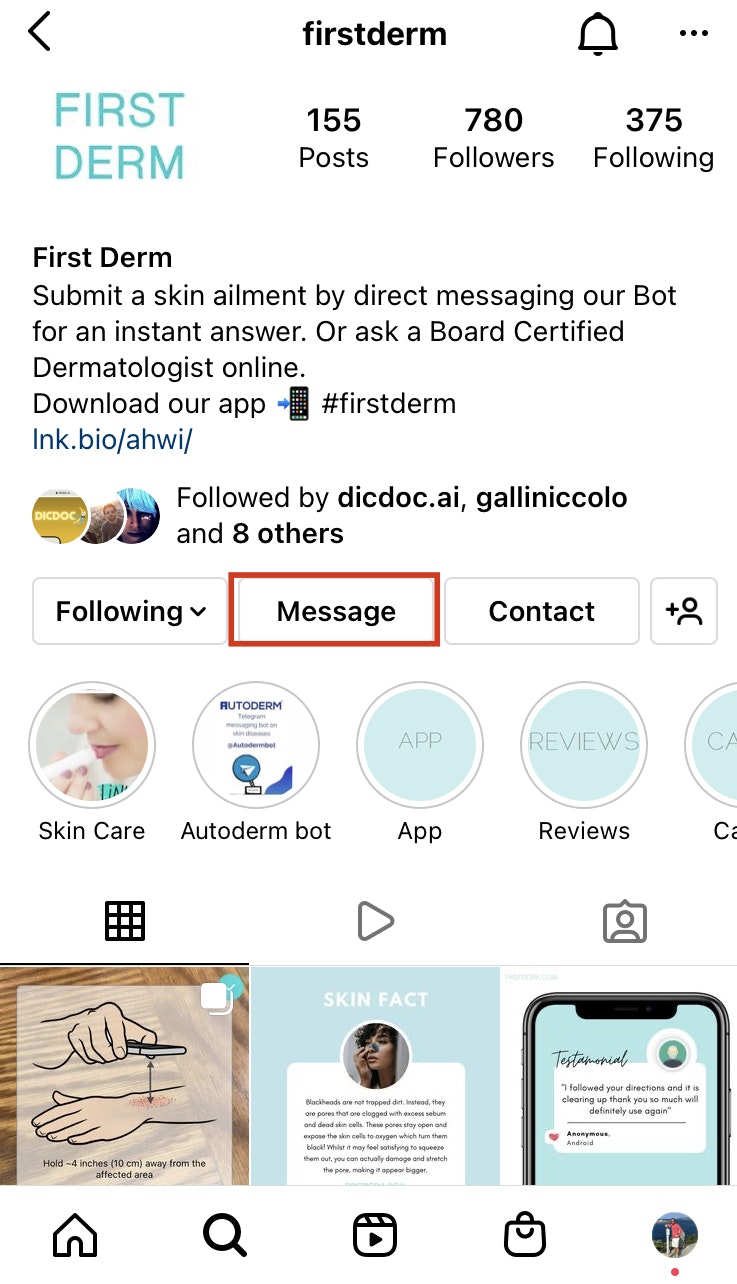 Instagram Direct Message Dermatology Bot gallery image
