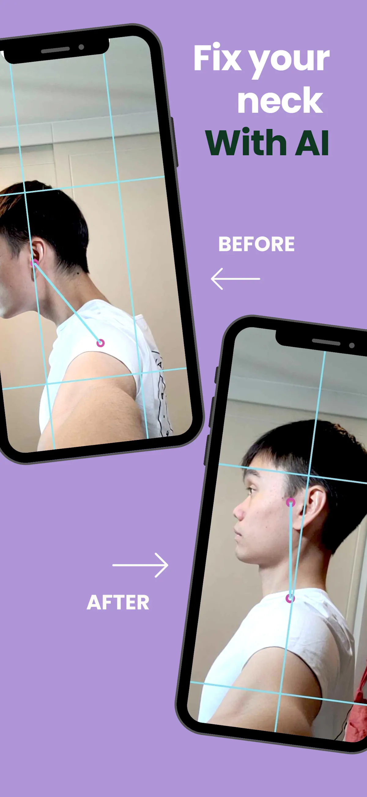 AI Posture Correction: NeckFit