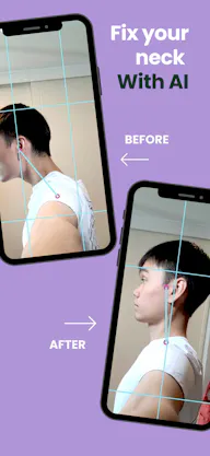 AI Posture Correction: NeckFit