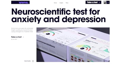 Anima β an eye-tracking solution gallery image