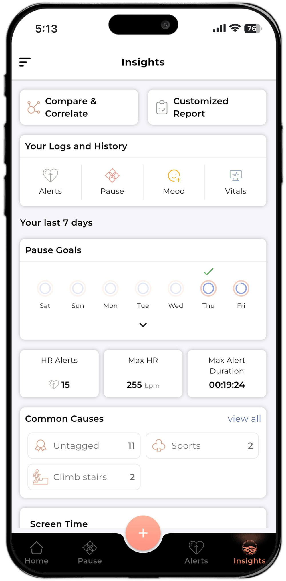 Pauser - Main product screenshot demonstrating key features and user interface