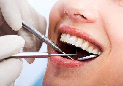 Root canal treatment in Greater Noida gallery image