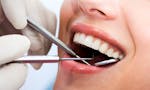 Root canal treatment in Greater Noida image