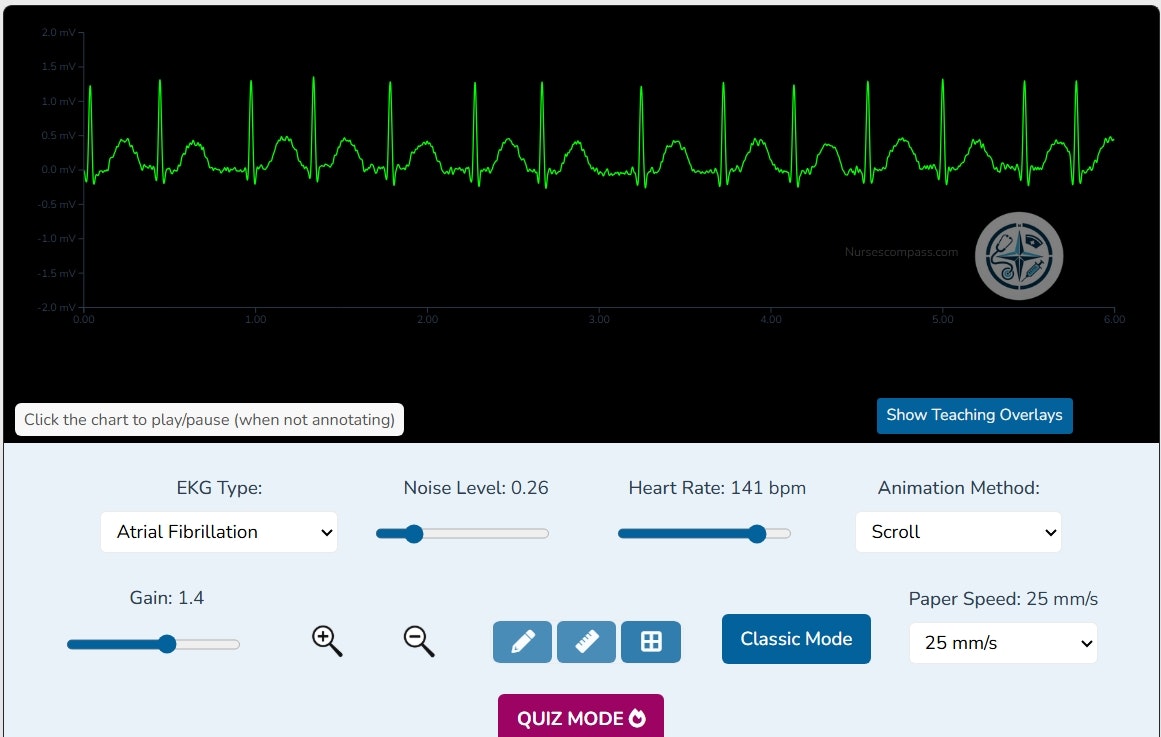 Nurses Compass EKG Simulator gallery image