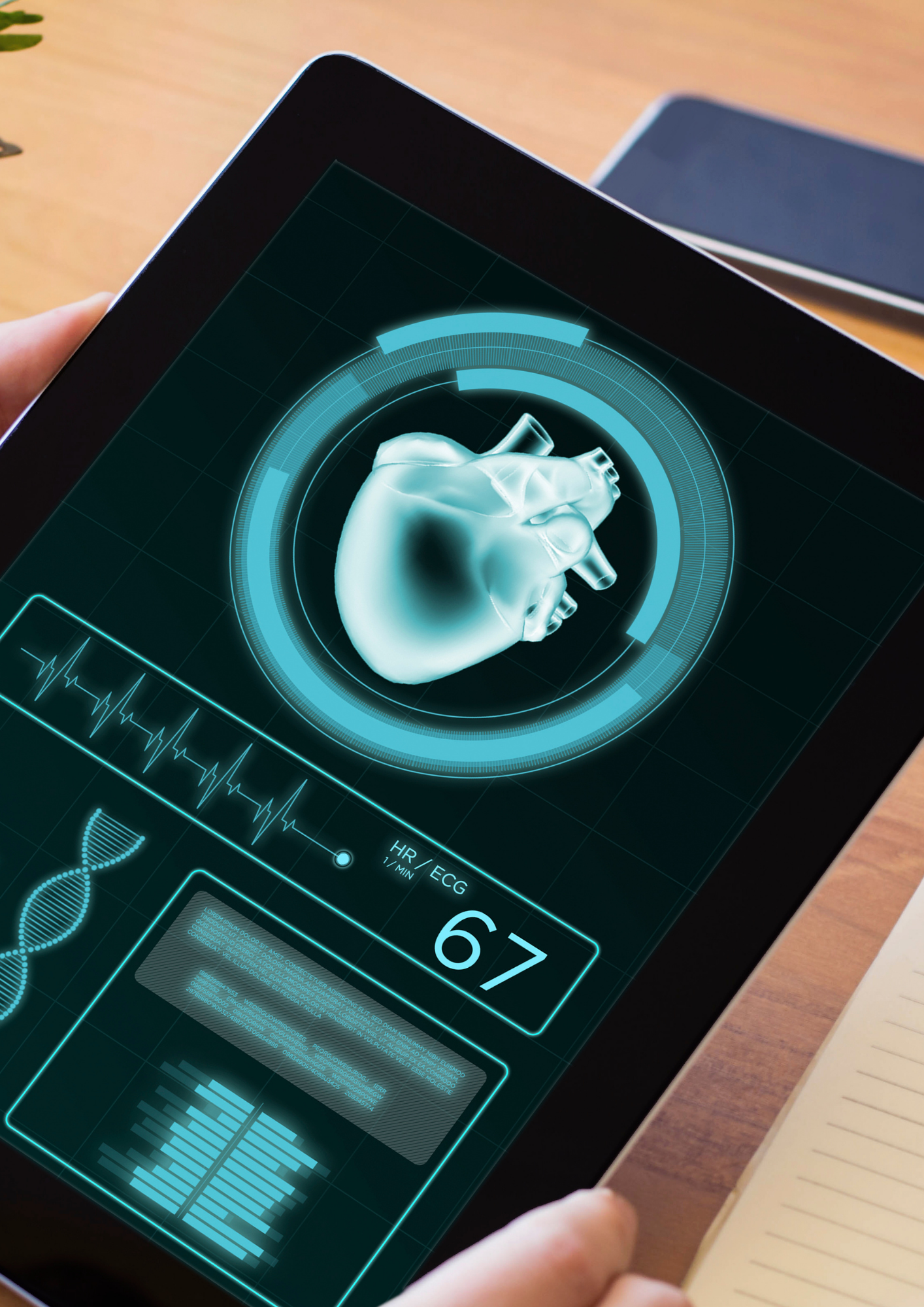 NerveCor gallery image