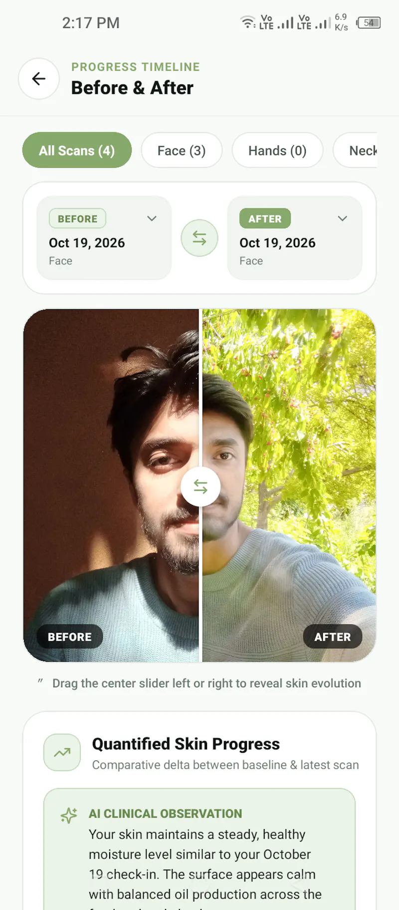 SkinCare AI: Routine & Scanner screenshot 8