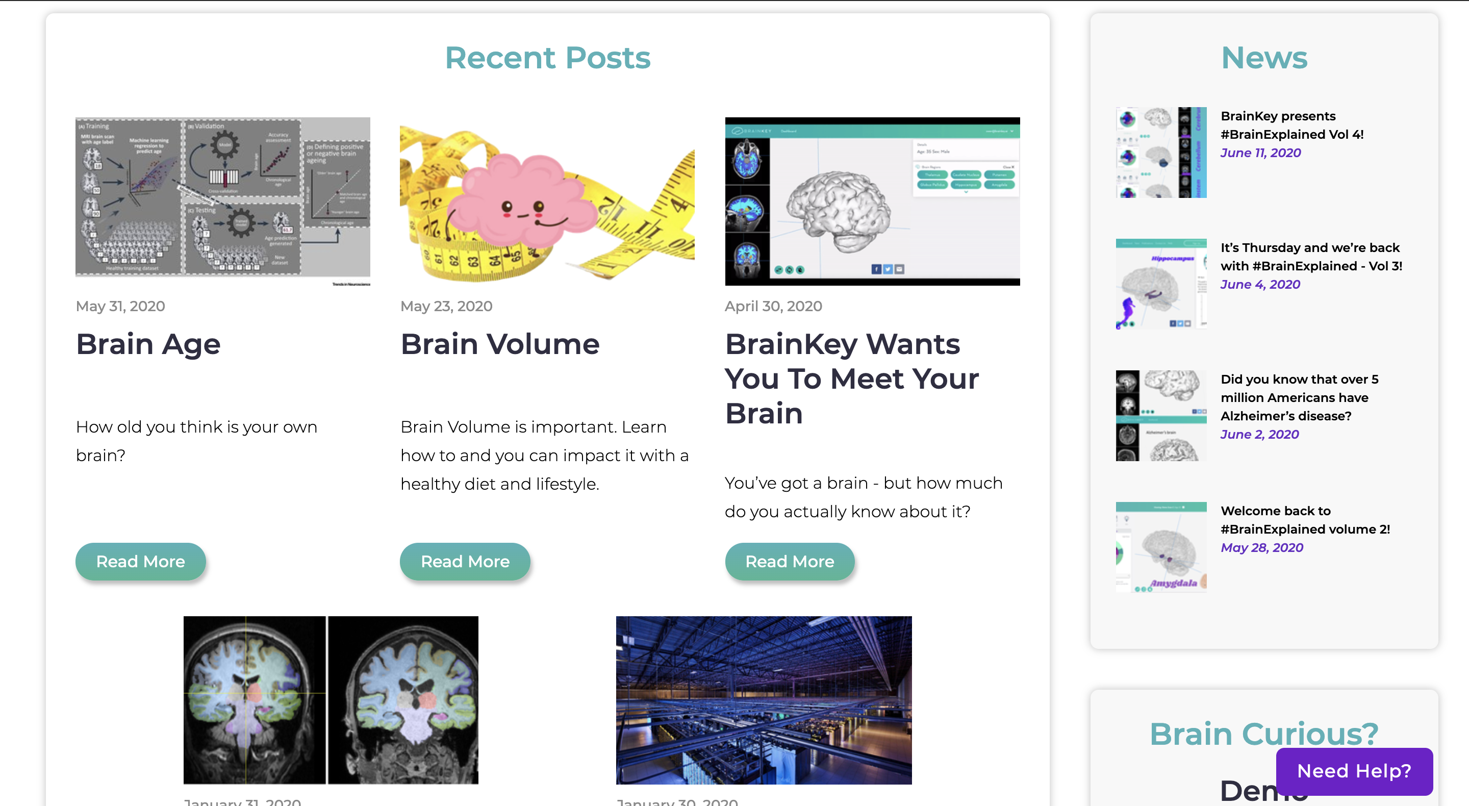 BrainKey gallery image