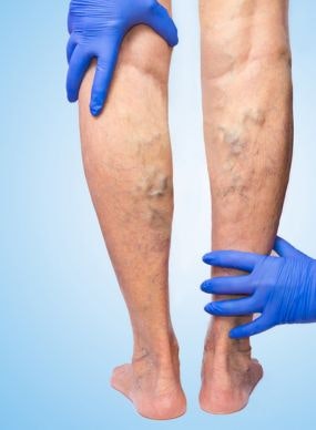 Dr Hans Ghostcraftman gallery image