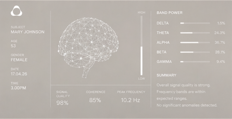 Nura Scan by Evolve Neuro gallery image