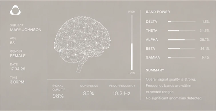 Nura Scan by Evolve Neuro screenshot 2