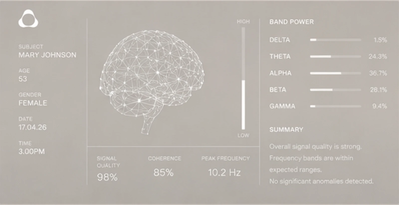 Nura Scan by Evolve Neuro screenshot 3