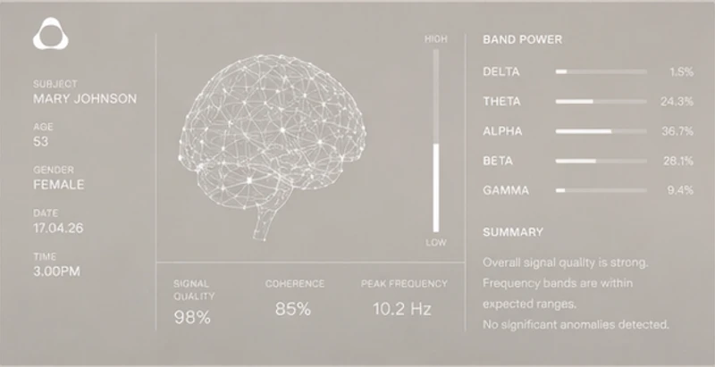 Nura Scan by Evolve Neuro screenshot 3